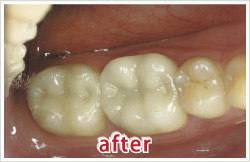 after