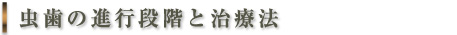 虫歯の進行段階と治療法
