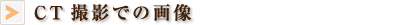 CT撮影での画像