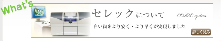 セレックについて