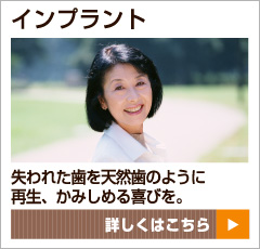 インプラント