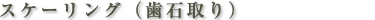 スケーリング（歯石取り）
